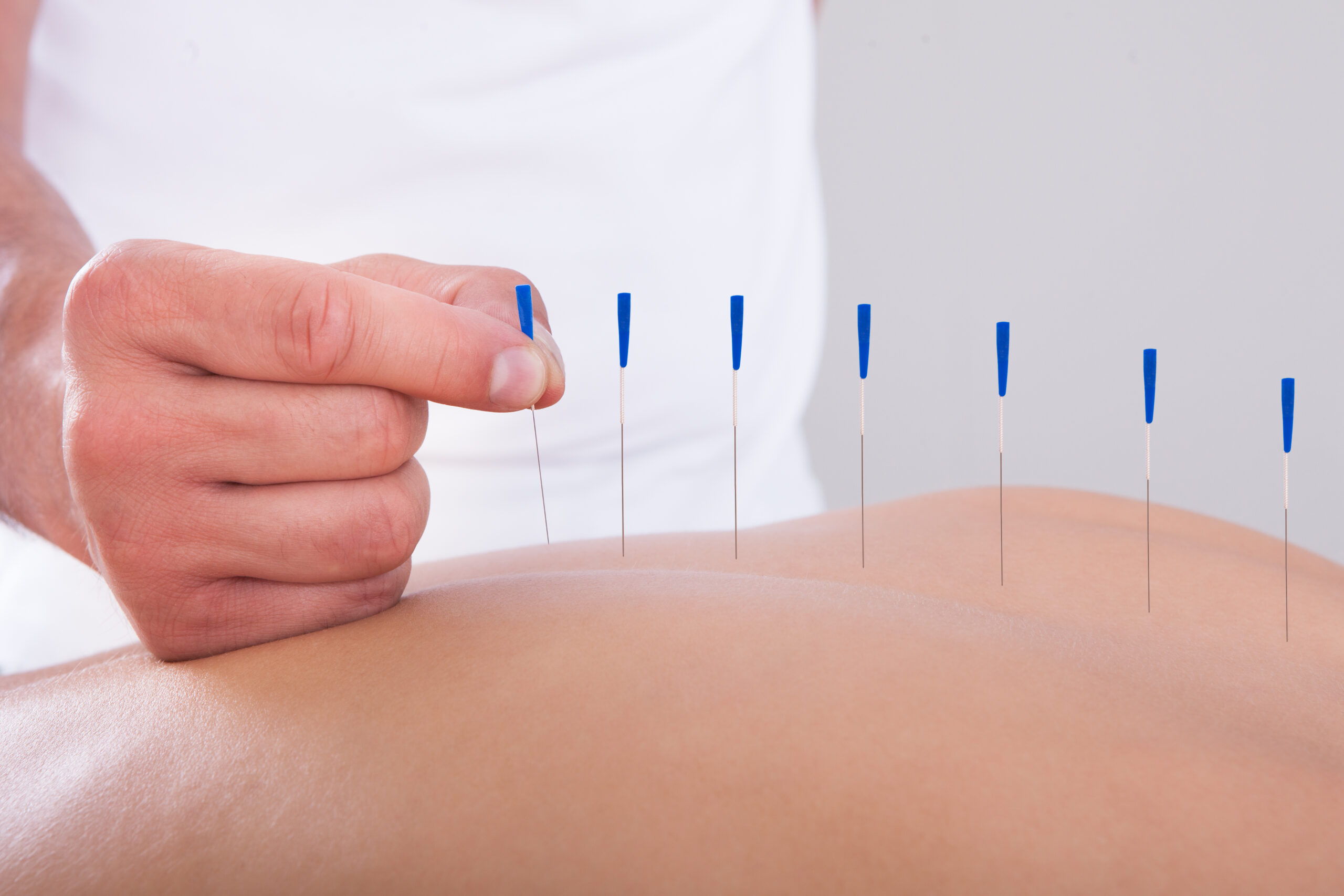 What role can complementary medicine play in managing endometriosis?